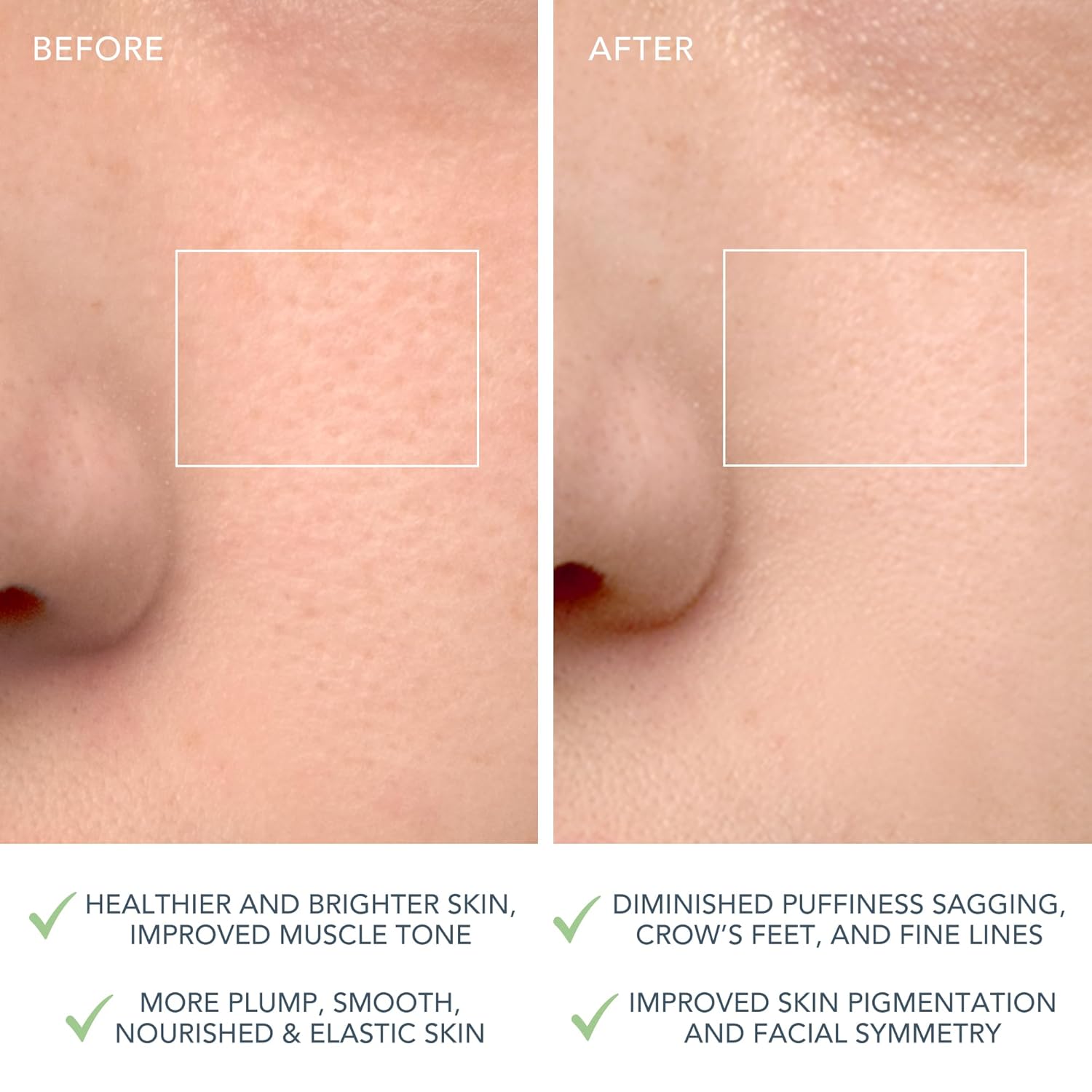 Foreo Luna 4 Facial Cleansing Smart Device - Performance Testing