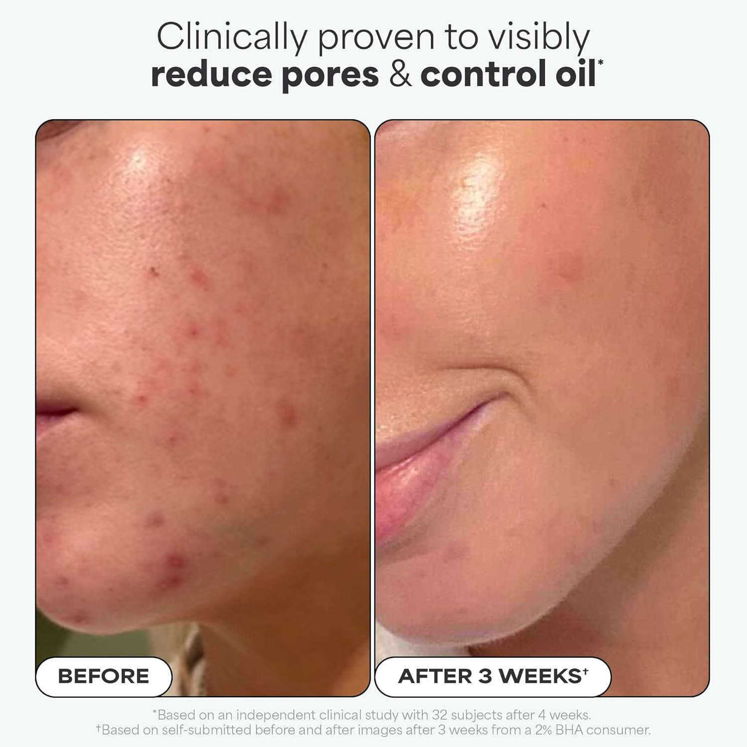 Paula's Choice 2% BHA Liquid Salicylic Acid Exfoliant - Performance Testing