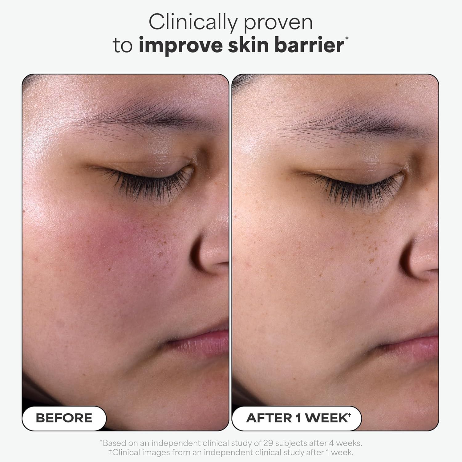 Paula's Choice 2% BHA Liquid Salicylic Acid Exfoliant - How It Compares