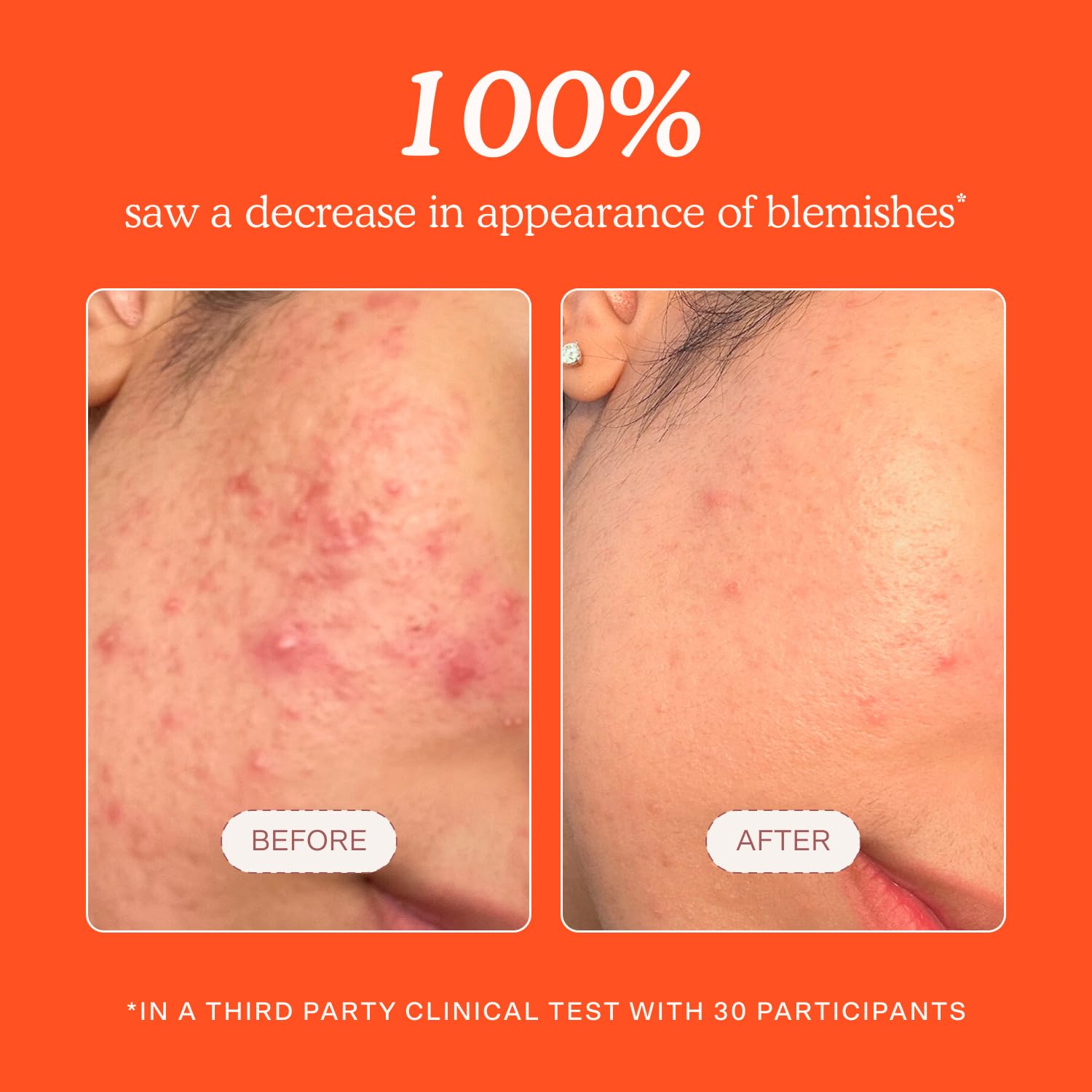 Tower 28 SOS Daily Rescue Facial Spray 4oz - Real-World Performance